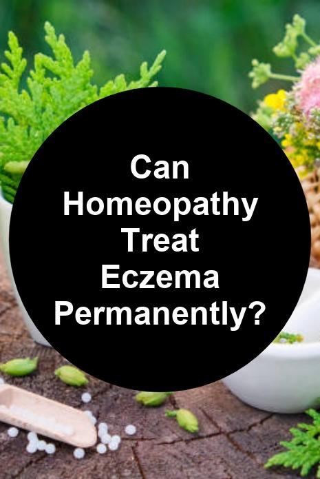 Can Homeopathy Treat Eczema Permanently Maxs Indoor Grow Shop 